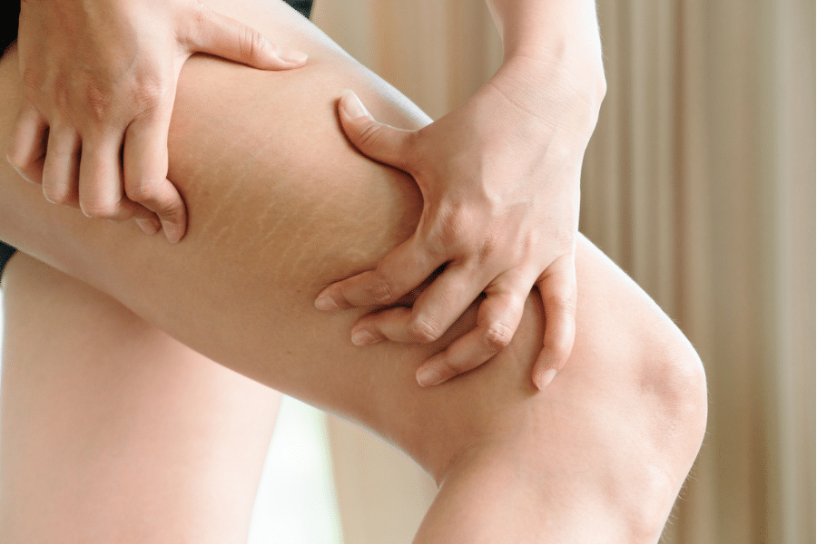 Bacak Germe Ameliyatı ile İlgili Sık Sorulan Sorular