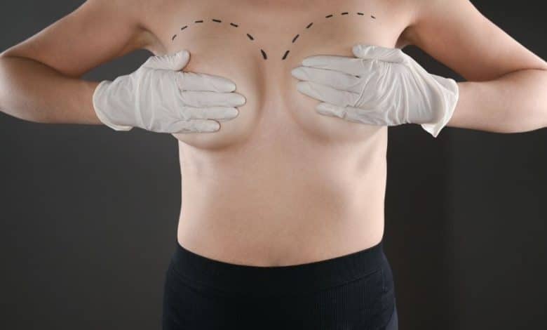 Breast Reductions Help to Eliminate Neck Pain, Posture Problems